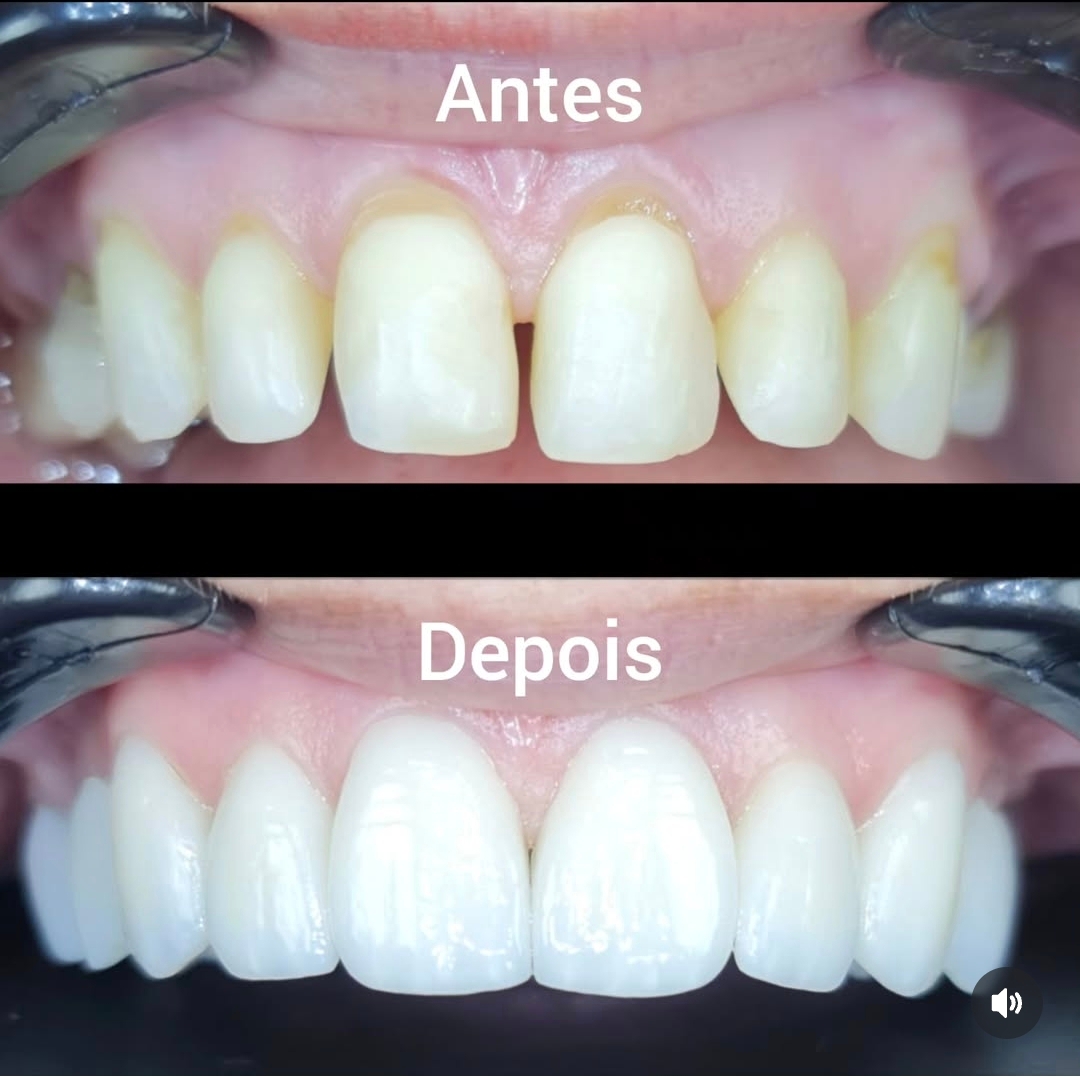Dentística Restauradora
